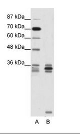 OLIG2 Antibody - A: Marker, B: Jurkat Cell Lysate.  This image was taken for the unconjugated form of this product. Other forms have not been tested.