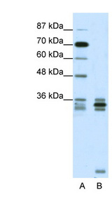 OLIG2 Antibody - OLIG2 antibody Western blot of Jurkat lysate. This image was taken for the unconjugated form of this product. Other forms have not been tested.