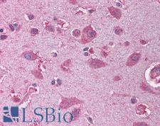 OLIG2 Antibody - Anti-OLIG2 antibody IHC of human brain, cortex. Immunohistochemistry of formalin-fixed, paraffin-embedded tissue after heat-induced antigen retrieval. Antibody concentration 5 ug/ml.  This image was taken for the unconjugated form of this product. Other forms have not been tested.