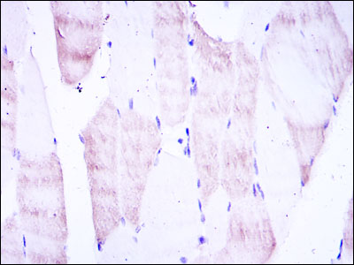 OLIG2 Antibody - IHC of paraffin-embedded muscle tissues using OLIG2 mouse monoclonal antibody with DAB staining.