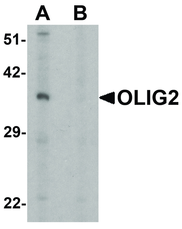 OLIG2 Antibody - Western blot analysis of OLIG2 in EL4 cell lysate with OLIG2 antibody at 1 ug/ml in (A) the absence and (B) the presence of blocking peptide.