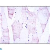 OLIG2 Antibody - Immunohistochemistry (IHC) analysis of paraffin-embedded muscle tissues with DAB staining using OLIG2 Monoclonal Antibody.