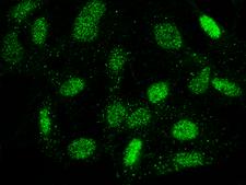 OLIG2 Antibody - Immunofluorescence staining of OLIG2 in U251MG cells. Cells were fixed with 4% PFA, permeabilzed with 0.3% Triton X-100 in PBS, blocked with 10% serum, and incubated with rabbit anti-Human OLIG2 polyclonal antibody (dilution ratio 1:5000) at 4°C overnight. Then cells were stained with the Alexa Fluor 488-conjugated Goat Anti-rabbit IgG secondary antibody (green). Positive staining was localized to cytoplasm and nucleus.