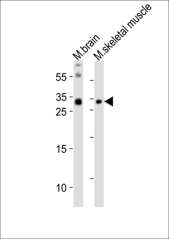 OLIG3 Antibody - Western blot of lysates from mouse brain, mouse skeletal muscle tissue lysate (from left to right), using OLIG3 antibody diluted at 1:1000 at each lane. A goat anti-rabbit IgG H&L (HRP) at 1:10000 dilution was used as the secondary antibody. Lysates at 20 ug per lane.