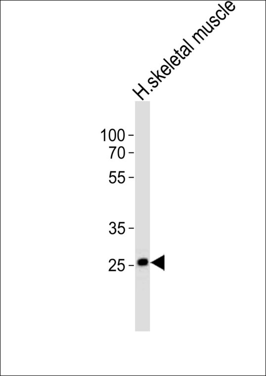OLIG3 Antibody - Western blot of lysate from human skeletal muscle tissue lysate with OLIG3 Antibody. Antibody was diluted at 1:1000. A goat anti-rabbit IgG H&L (HRP) at 1:10000 dilution was used as the secondary antibody. Lysate at 20 ug.