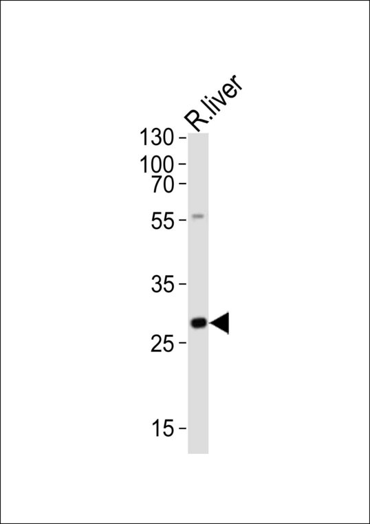 OLIG3 Antibody - Western blot of lysate from rat liver tissue lysate, using Olig3 antibody diluted at 1:1000. A goat anti-rabbit IgG H&L (HRP) at 1:10000 dilution was used as the secondary antibody. Lysate at 20 ug.