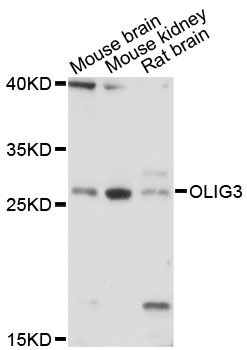 OLIG3 Antibody - Western blot analysis of extracts of various cell lines, using OLIG3 antibody at 1:3000 dilution. The secondary antibody used was an HRP Goat Anti-Rabbit IgG (H+L) at 1:10000 dilution. Lysates were loaded 25ug per lane and 3% nonfat dry milk in TBST was used for blocking. An ECL Kit was used for detection and the exposure time was 1s.