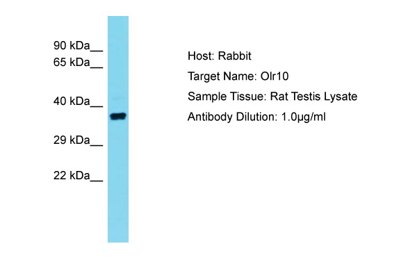 Olr10 Antibody -  This image was taken for the unconjugated form of this product. Other forms have not been tested.