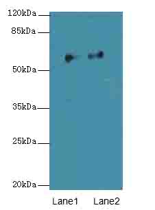OMA1 Antibody - Western blot. All lanes: OMA1 antibody at 4 ug/ml. Lane 1: COLO205 whole cell lysate. Lane 2: MCF7 whole cell lysate. Secondary Goat polyclonal to Rabbit IgG at 1:10000 dilution. Predicted band size: 60 kDa. Observed band size: 60 kDa.