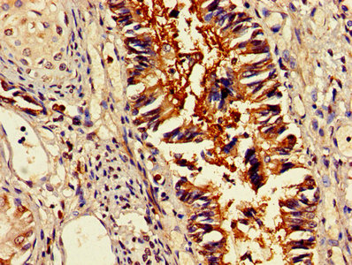 OMA1 Antibody - IHC image of OMA1 Antibody diluted at 1:400 and staining in paraffin-embedded human lung tissue performed on a Leica BondTM system. After dewaxing and hydration, antigen retrieval was mediated by high pressure in a citrate buffer (pH 6.0). Section was blocked with 10% normal goat serum 30min at RT. Then primary antibody (1% BSA) was incubated at 4°C overnight. The primary is detected by a biotinylated secondary antibody and visualized using an HRP conjugated SP system.