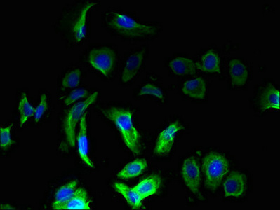 OMA1 Antibody - Immunofluorescence staining of MCF-7 cells with OMA1 Antibody at 1:133, counter-stained with DAPI. The cells were fixed in 4% formaldehyde, permeabilized using 0.2% Triton X-100 and blocked in 10% normal Goat Serum. The cells were then incubated with the antibody overnight at 4°C. The secondary antibody was Alexa Fluor 488-congugated AffiniPure Goat Anti-Rabbit IgG(H+L).