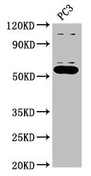 OMA1 Antibody - Western Blot Positive WB detected in: PC-3 whole cell lysate All lanes: OMA1 antibody at 2.7µg/ml Secondary Goat polyclonal to rabbit IgG at 1/50000 dilution Predicted band size: 61, 56 kDa Observed band size: 56 kDa