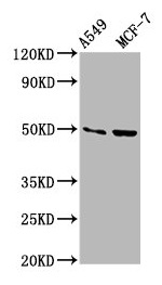 OMD / Osteomodulin Antibody - Western Blot Positive WB detected in: A549 whole cell lysate, MCF-7 whole cell lysate All lanes: OMD antibody at 3.5µg/ml Secondary Goat polyclonal to rabbit IgG at 1/50000 dilution Predicted band size: 50 kDa Observed band size: 50 kDa
