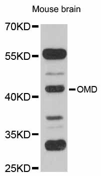 OMD / Osteomodulin Antibody - Western blot analysis of extracts of mouse brain, using OMD antibody at 1:1000 dilution. The secondary antibody used was an HRP Goat Anti-Rabbit IgG (H+L) at 1:10000 dilution. Lysates were loaded 25ug per lane and 3% nonfat dry milk in TBST was used for blocking. An ECL Kit was used for detection and the exposure time was 90s.