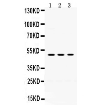 OMG / OMGP Antibody - OMG antibody Western blot. All lanes: Anti OMG at 0.5 ug/ml. Lane 1: Rat Brain Tissue Lysate at 50 ug. Lane 2: Mouse Brain Tissue Lysate at 50 ug. Lane 3: U87 Whole Cell Lysate at 40 ug. Predicted band size: 50 kD. Observed band size: 50 kD.