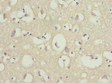 OMG / OMGP Antibody - Immunohistochemistry of paraffin-embedded human brain tissue at dilution 1:100