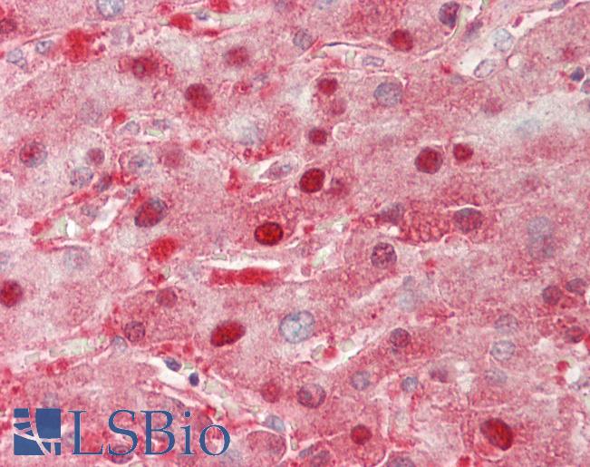 OMP Antibody - Human Liver: Formalin-Fixed, Paraffin-Embedded (FFPE).  This image was taken for the unconjugated form of this product. Other forms have not been tested.