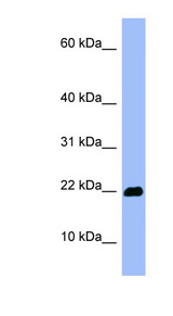 OMP Antibody - OMP antibody western blot of HepG2 cell lysate.  This image was taken for the unconjugated form of this product. Other forms have not been tested.