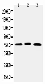 ONECUT1 / HNF6 Antibody - WB of ONECUT1 / HNF6 antibody. Lane 1: Rat Liver Tissue Lysate. Lane 2: Mouse Liver Tissue Lysate. Lane 3: HELA Cell Lysate.