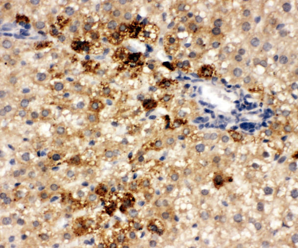ONECUT1 / HNF6 Antibody - ONECUT1 / HNF6 antibody. IHC(P): Rat Liver Tissue.