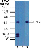 ONECUT1 / HNF6 Antibody - Western blot of HNF6 in human pancreas in the 1) absence and 2) presence of immunizing peptide, and 3) rat pancreas using Peptide-affinity Purified Polyclonal Antibody to HNF6 at 4 ug/ml. Goat anti-rabbit Ig HRP secondary antibody, and PicoTect ECL substrate solution were used for this test.