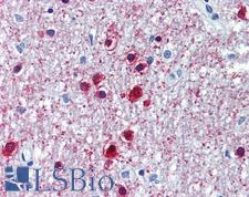 ONECUT1 / HNF6 Antibody - Anti-ONECUT1 antibody IHC of human brain, cerebellum. Immunohistochemistry of formalin-fixed, paraffin-embedded tissue after heat-induced antigen retrieval. Antibody concentration 5 ug/ml.  This image was taken for the unconjugated form of this product. Other forms have not been tested.