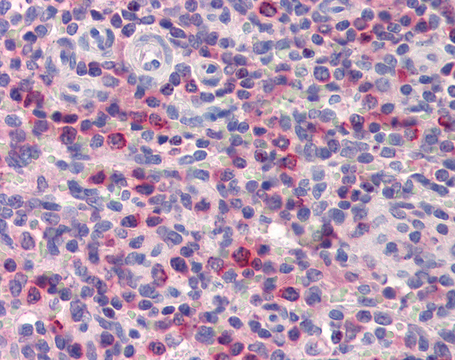 ONECUT1 / HNF6 Antibody - Anti-ONECUT1 antibody IHC of human spleen. Immunohistochemistry of formalin-fixed, paraffin-embedded tissue after heat-induced antigen retrieval. Antibody concentration 5 ug/ml.  This image was taken for the unconjugated form of this product. Other forms have not been tested.