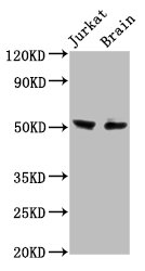 ONECUT1 / HNF6 Antibody - Positive Western Blot detected in Jurkat whole cell lysate, Rat brain tissue. All lanes: ONECUT1 antibody at 7.6 µg/ml Secondary Goat polyclonal to rabbit IgG at 1/50000 dilution. Predicted band size:52 KDa. Observed band size: 52 KDa