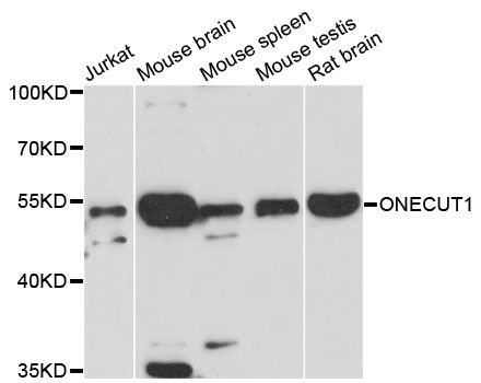 ONECUT1 / HNF6 Antibody - Western blot analysis of extracts of various cell lines, using ONECUT1 antibody at 1:3000 dilution. The secondary antibody used was an HRP Goat Anti-Rabbit IgG (H+L) at 1:10000 dilution. Lysates were loaded 25ug per lane and 3% nonfat dry milk in TBST was used for blocking. An ECL Kit was used for detection and the exposure time was 90s.