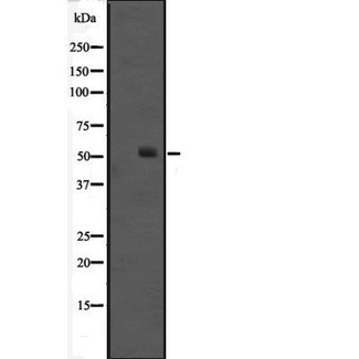 ONECUT1 / HNF6 Antibody - Western blot analysis of HNF6 expression in Jurkat cells lysate. The lane on the left is treated with the antigen-specific peptide.