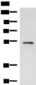 ONECUT1 / HNF6 Antibody - Western blot analysis of Rat liver tissue lysate  using ONECUT1 Polyclonal Antibody at dilution of 1:600