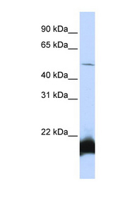 ONECUT1 / HNF6 Antibody - ONECUT1 antibody Western blot of HepG2 cell lysate. This image was taken for the unconjugated form of this product. Other forms have not been tested.