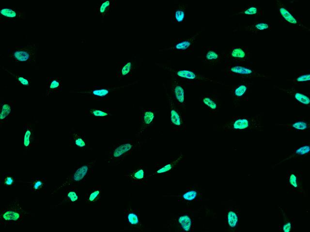 ONECUT1 / HNF6 Antibody - Immunofluorescence staining of ONECUT1 in HeLa cells. Cells were fixed with 4% PFA, permeabilzed with 0.1% Triton X-100 in PBS, blocked with 10% serum, and incubated with rabbit anti-Human ONECUT1 polyclonal antibody (dilution ratio 1:1000) at 4°C overnight. Then cells were stained with the Alexa Fluor 488-conjugated Goat Anti-rabbit IgG secondary antibody (green) and counterstained with DAPI (blue). Positive staining was localized to Nucleus.