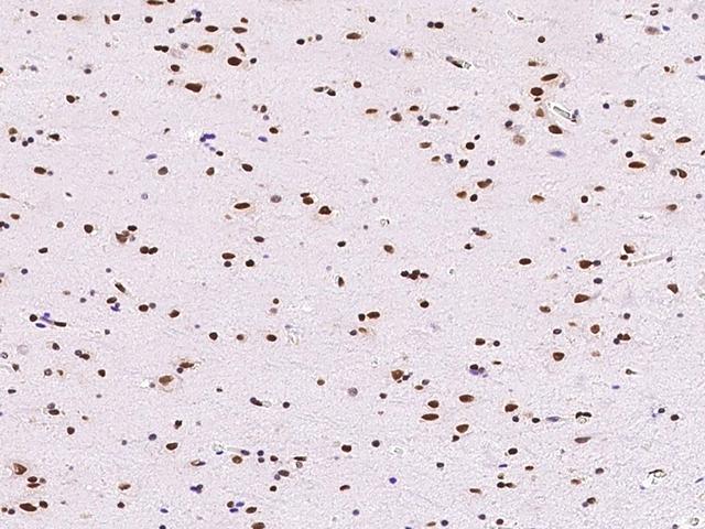 ONECUT1 / HNF6 Antibody - Immunochemical staining ONECUT1 in human brain with rabbit polyclonal antibody at 1:1000 dilution, formalin-fixed paraffin embedded sections.