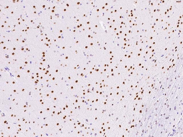 ONECUT1 / HNF6 Antibody - Immunochemical staining ONECUT1 in rat brain with rabbit polyclonal antibody at 1:1000 dilution, formalin-fixed paraffin embedded sections.