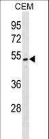 ONECUT2 / OC2 Antibody - ONECUT2 Antibody western blot of CEM cell line lysates (35 ug/lane). The ONECUT2 antibody detected the ONECUT2 protein (arrow).