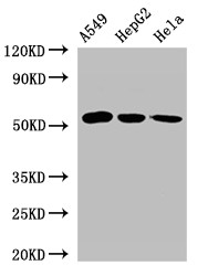 ONECUT2 / OC2 Antibody - Positive WB detected in:A549 whole cell lysate,HepG2 whole cell lysate,Hela whole cell lysate;All lanes:ONECUT2 antibody at 2.4?g/ml;Secondary;Goat polyclonal to rabbit IgG at 1/50000 dilution;Predicted band size: 55 KDa;Observed band size: 55 KDa;