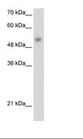 ONECUT3 / OC3 Antibody - HepG2 Cell Lysate.  This image was taken for the unconjugated form of this product. Other forms have not been tested.