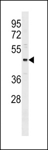 ONECUT3 / OC3 Antibody - ONECUT3 Antibody western blot of MDA-MB231 cell line lysates (35 ug/lane). The ONECUT3 antibody detected the ONECUT3 protein (arrow).