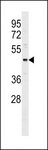 ONECUT3 / OC3 Antibody - ONECUT3 Antibody western blot of MDA-MB231 cell line lysates (35 ug/lane). The ONECUT3 antibody detected the ONECUT3 protein (arrow).