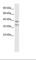 ONECUT3 / OC3 Antibody - Jurkat Cell Lysate.  This image was taken for the unconjugated form of this product. Other forms have not been tested.