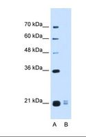 OOSP2 / PLAC1L Antibody - Lane A: Marker. Lane B: HepG2 cell lysate. Antibody concentration: 0.5 ug/ml. Gel concentration: 12%.  This image was taken for the unconjugated form of this product. Other forms have not been tested.