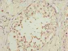 OOSP2 / PLAC1L Antibody - Immunohistochemistry of paraffin-embedded human testis tissue using antibody at dilution of 1:100.