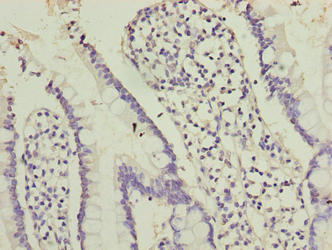 OOSP2 / PLAC1L Antibody - Immunohistochemistry of paraffin-embedded human small intestine tissue using OOSP2 Antibody at dilution of 1:100