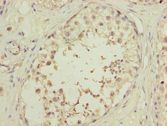 OOSP2 / PLAC1L Antibody - Immunohistochemistry of paraffin-embedded human testis tissue using OOSP2 Antibody at dilution of 1:100