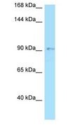 OPA1 Antibody - OPA1 antibody Western Blot of HT1080.  This image was taken for the unconjugated form of this product. Other forms have not been tested.