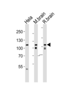 OPA1 Antibody - Western blot of lysates from HeLa cell line , mouse brain and rat brain tissue lysate (from left to right) with OPA1 (form S1) Antibody. Antibody was diluted at 1:1000 at each lane. A goat anti-rabbit IgG H&L (HRP) at 1:5000 dilution was used as the secondary antibody. Lysates at 35 ug per lane.
