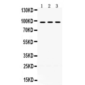 OPA1 Antibody - OPA1 antibody Western blot. All lanes: Anti OPA1 at 0.5 ug/ml. Lane 1: A549 Whole Cell Lysate at 40 ug. Lane 2: SKOV Whole Cell Lysate at 40 ug. Lane 3: SW620 Whole Cell Lysate at 40 ug. Predicted band size: 95 kD. Observed band size: 95 kD.