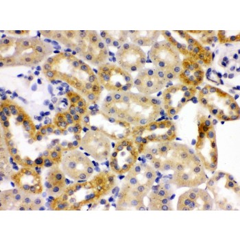 OPA1 Antibody - OPA1 antibody IHC-paraffin. IHC(P): Rat Kidney Tissue.