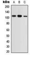 OPA1 Antibody - Western blot analysis of OPA1 expression in A549 (A); Raw264.7 (B); PC12 (C) whole cell lysates.